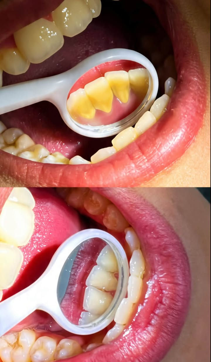 علاج مجاني • الدورة • كلية طب الأسنان