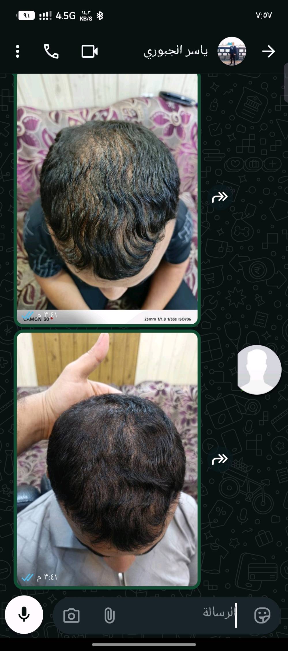 موصل وادي حجر • زيوت عبدو • وقف التساقط