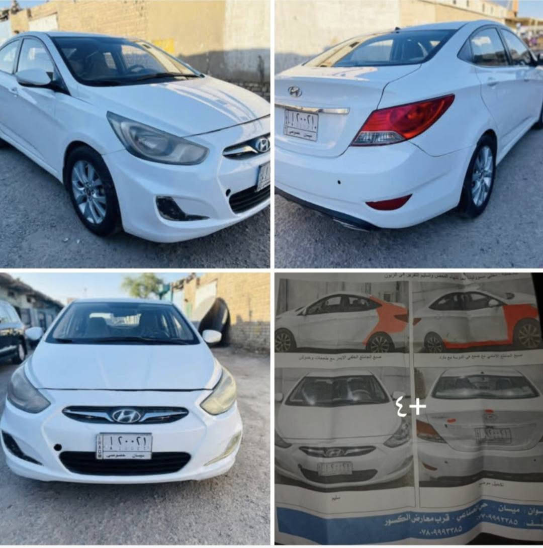 اكسنت موديل 2015 مكينه 1400 دوش لاتبخير ولا تنقيص،رقم ميسان شرط تحويل  بيها ضربات بسيطه بدون دواخل.،السونار مرفق بالصوره ، بيها خلل بالكير  يشكل على النمره 4 ويرجع طبيعي  السعر ٦٣  وبيها مجال ، ‏‪***********‬‏
