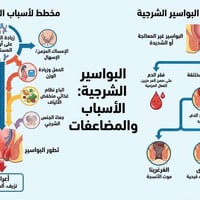 البواسير الشرجية هي انتفاخ أو تورم في الأوردة المتواجدة في الجزء السفل...