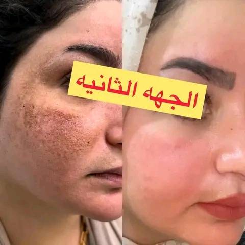 حليب امج الطاهره • تصفية الوجه • بدون مكياج