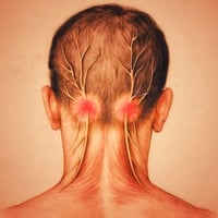 حجامة • قذالية الرقبة • صداع