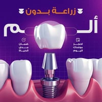 زراعة الأسنان • دكتورة طيبه • سوق عون