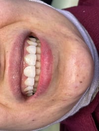 حشوات تجميلية • آية الزيدي • الطوبجي