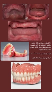 عيادات جامعة المعارف • طقم اسنان متحرك • تنظيف اسنان