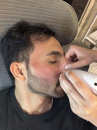 منظف مسام • شفط هوائي • ٤ رؤوس