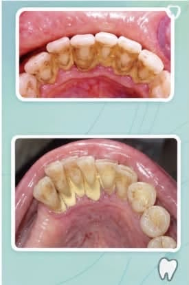 علاج مجاني • أطباء مختصين • جامعة كلكامش