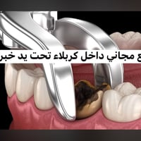كربلاء • قلع أسنان مجاني • عدد محدود