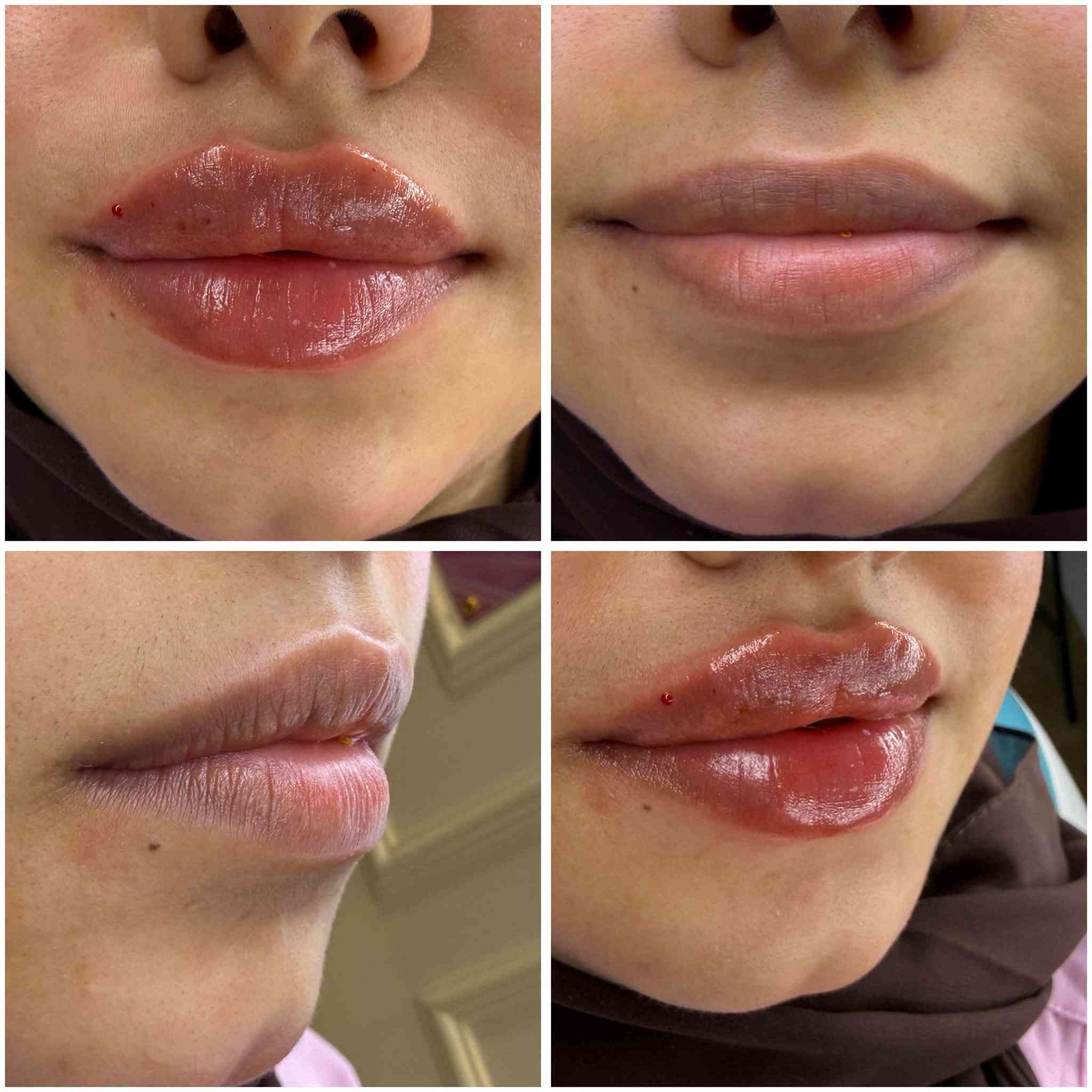 ✨ قريبًا… افتتاح قسم الجلدية والتجميل ✨

في Nile Beauty نحضّر لكم تجربة جديدة ومتكاملة للعناية بالجمال والبشرة. 🤍

🌸 خدمات جلدية وتجميلية
✨ عناية متخصصة ولمسات جمالية تليق بكم

ترقّبوا الافتتاح قريبًا… والمفاجآت أجمل! 💎

📍 الموقع: النعمانية
📞 للحجز والاستفسار: *********** – ***********

NILE BEAUTY
جمالك… ثقتك… إشراقتك ✨
