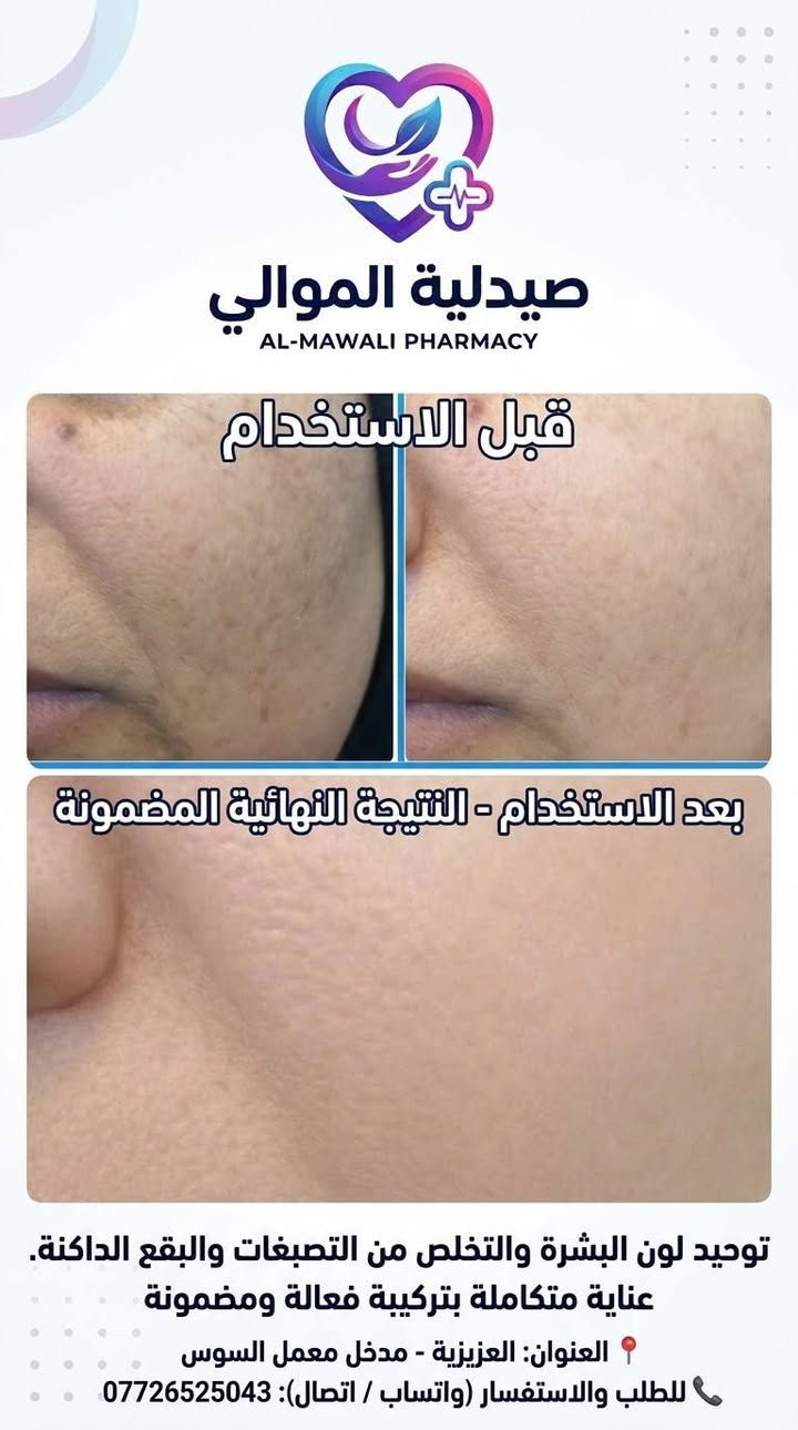 صيدلية الموالي💊🥰
متخصصون في الاستشارات الجلدية والعناية بالبشرة والشعر
مع توفير كافة الأدوية والمستلزمات الطبية بأعلى جودة
📍واسط العزيزية مدخل معمل السوس 
 للاستفسار المراسلة على الخاص او الاتصال واتساب ***********

نص مكتوب في الصور:
- صيدلية الموالي AL-MAWALI PHARMACY Before and After BEFORE / قبل AFTER / بعد النتيجة بعد استخدام علاج حب الشباب وآثاره العزيزية - مدخل معمل السوس ***********
- صيدلية الموالي
- AL-MAWALI PHARMACY
- قبل الاستخدام
- بعد الاستخدام - النتيجة النهائية المضمونة
- توحيد لون البشرة والتخلص من التصبغات والبقع الداكنة.
- عناية متكاملة بتركيبة فعالة ومضمونة
- العنوان: العزيزية - مدخل معمل السوس
- للطلب والاستفسار (واتساب / اتصال): ***********