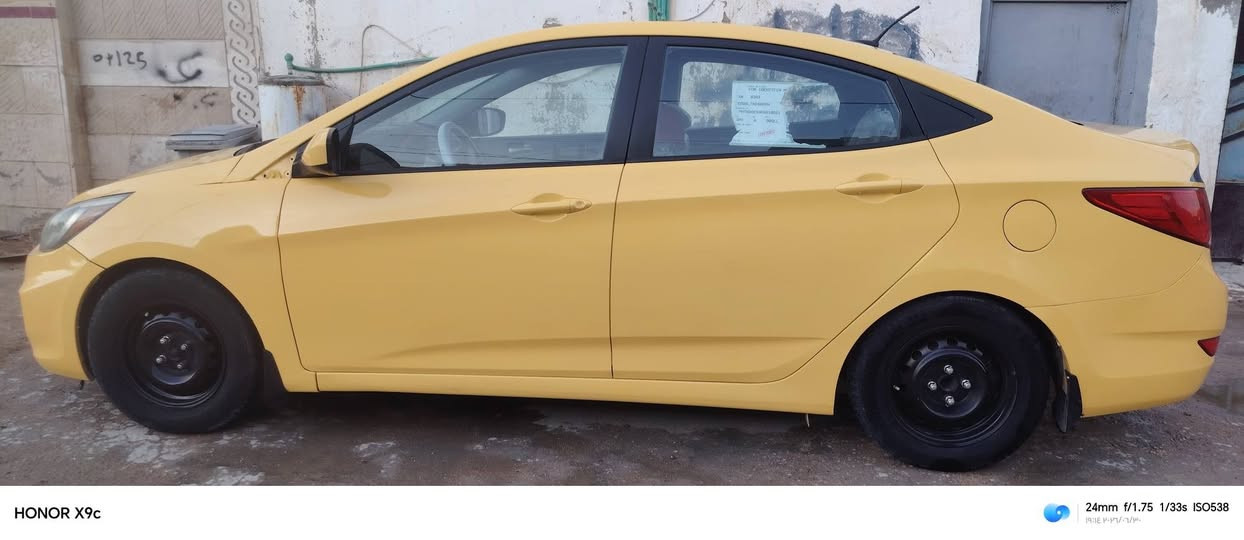 سلام عليكم اكسن2016 امريكي ليبل واحد فقط رقم بغداد جاملغ السايق وخشم بنيد مكينه 600 حداديه تبريد تدفئه مكينه كير سنويه ال 2031 بسمي هزه جديده مداور ثاني يوم سعر 80 مجال قليل  مكلف بل نشر مكلف بل نشر ***********
