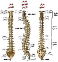 علاج الانزلاق • حجامة • صداع نصفي