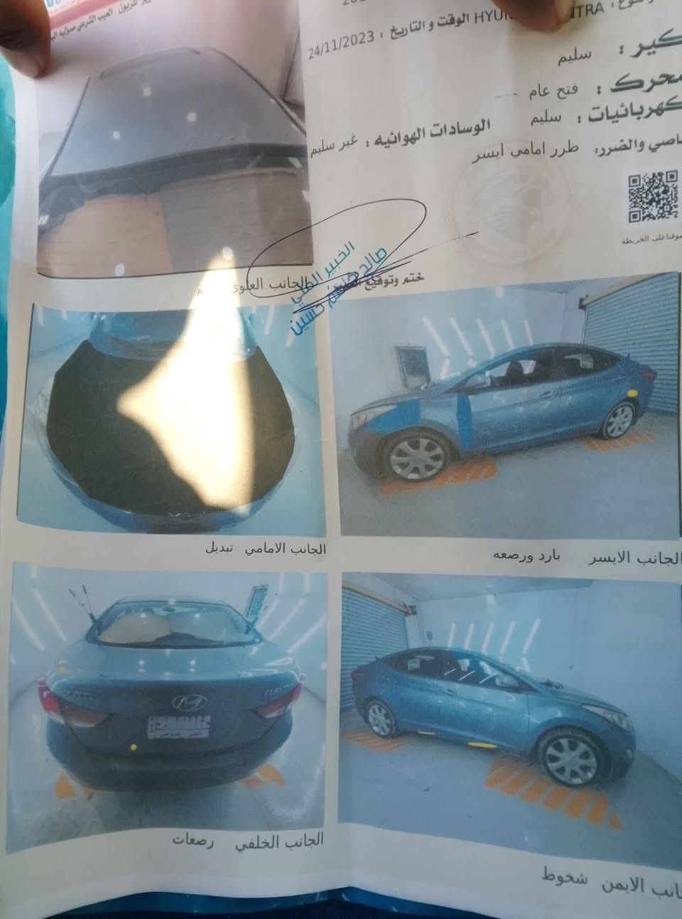 سلام عليكم النترا البيع موديل 13 فول مواصفات عده البصمه خليجي محرك وتبريد جديد ستوني شادهن سياره خير من الله رقم مثنئ بسمي مداور ثاني يوم السعر 108 وبيهه مجال ***********

