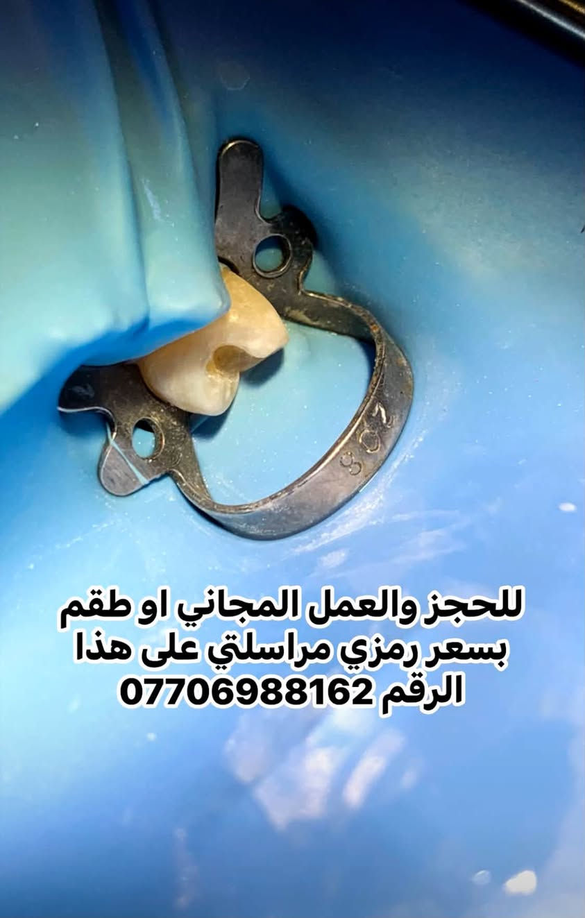 اهلنا في محافظة كربلاء 📌📌📌

عالج اسنانك بشكل مجاني بالكامل (عدا الطقم بسعر رمزي جداً ) العلاجات المتوفرة حالياً:
1-حشوات بيضاء لجميع الاسنان المتسوسة 
2-حشوات جذور للاسنان الامامية
3-علاج اسنان الاطفال وحمايتها من التسوس 
4- قلع الاسنان التالفة للكبار والاطفال
5- قلع اسنان العقل سواء فوق او تحت اللثة(جراحي)
6-اشعة للسن 
7-اشعة للفكين بالكامل ثنائية وثلاثية الابعاد ومفصل الفك 
8-اشعة نوع خاص للتقويم
9- علاج تقرحات الفم واللثة وما حول الفم
10-تنظيف الاسنان من التكلسات وازالة التصبغات (نتيجة التدخين وغيرها من الاطعمة والمشروبات)
11-طقم جزئي 
12-طقم كامل للاسنان 

رقمي للتواصل*********** 
حساب الانستاغرام لتوثيق الحالات i6-40 
العنوان كربلاء -حي الموظفين
