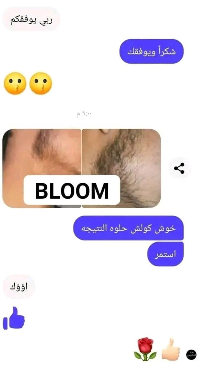 💥💥جديدنا 💥💥
زيت لنمو وزيادة كثافة الشعر واللحية
يعزز من نمو وكثافة الشعر . يعمل على تكثيف عميق ويسهل من تصفيف الشعر المجعد ؛ يزيد لمعانه ويغذيه . 
✅️ غني بمجموعة متنوعة من العناصر الغذائية الطبيعية 
☑️️ يقوي من يصيلات الشعر الخاملة
✔️ نتيجة سريعة جداا خلال ايام معدودة
✔️يصلح للبشرة الحساسة والجافة 
✳️️ يصلح ويفعل من نمو الشعيرات الخاملة

نص مكتوب في الصور:
- الحل لنمو وتكثيف اللحيه بوقت قياسي جدآ زيت اصلي خاآم
- السلام عليكم
- شلونه مكثف اللحيه
- اللي استخدمه
- ردت أسألك قبل فتره ونسيت
- تم الرد عليك بواسطة محمد
- وعليكم السلام
- منتج فول عاشت اديكم
- الحمدلله
- لقد قمت بالرد على محمد
- الف عافيه
- ربي يوفقكم شكراً ويوفقك ٩:٠٠ م BLOOM خوش كولش حلوه النتيجه استمر اؤؤك
