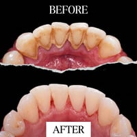 مجاناً • خدمات طب اسنان • البصرة الزبير
