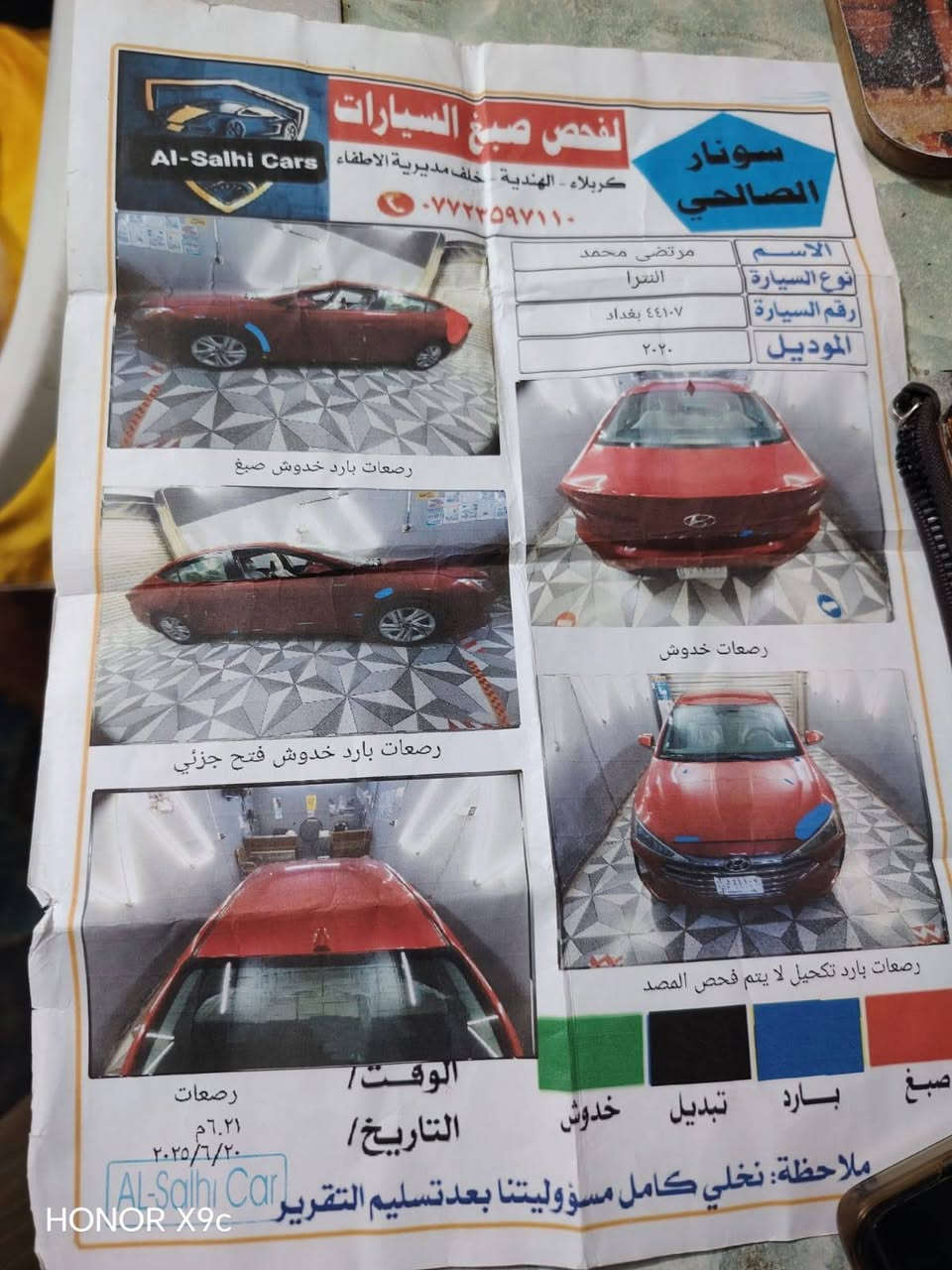 السلام عليكم النتره
للبيع السياره خير من الله
رقم بغداد السعر 135 وبيه
مجال الاستفسار ***********

