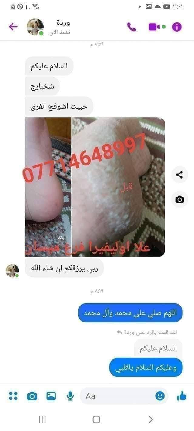 سبب حرارة الصيف واغلبيتنه راح نعاني من تشققات الاقدام وخشونتها بسبب الحراره 😞 ولا يهمكم حبايبي جبتلكم كريم علا اوليفيرا السحري المعجزه بكج كامل 🌟الي راح يخلي اقدامكم نااعمه مثل اقدام الاطفال 💎

نص مكتوب في الصور:
- +964 773 877 *********** شوفى رجلينه كلش جانت يصبن دم والله العضيم ٣ ايام خليته اله العلاج وتعالجن رجليه حتى لايده خليت صارن كلش زينات ***********97
- +964776591
- ***********
- BAN
- علا اوليفيرا!
- بان مهدي صالح
- 077
- مراسلة
- علا اوليفيرا فرع ميسان ***********
- +9647732591 *********** علا اوليفيرا ٠٥:١٧ ص بان مهدي صالح شوفي الفرق ٠٥:٢٢ ص خيه انتي رحمه من الله انطاج النه ايدج وعلاجج بي العافيه ٠٥:٢٣ ص صباح الورد ٠٥:٢٩ ص صلوات عل . محمد هآا . محمد مراسلة
- علا اوليفيرا فرع ميسان *********** هاي قبل العلاج علا اوليفيرا فرع ميسان *********** علا اوليفيرا فرع ميسان *********** هاي بعد االعلاج
- وردة
- نشط الآن
- ٧:٥٩ م
- السلام عليكم
- شخبارج
- حبيت اشوفج الفرق
- ***********
- قبل
- بعد
- علا اوليفيرا فرع ميسان
- ربي يرزقكم ان شاء الله
- ٨:١٩ م
- اللهم صلي على محمد وآل محمد
- لقد قمت بالرد على وردة
- وعليكم السلام ياقلبي
- Aa
- +964 77 2599
- ايي هم نسيت ٠٩:٣٤ م
- ***********
- هاي رجليه اليوم ٠٩:٣٤ م
- بعد استخدام مره وحده ٠٩:٣٥ م
- احسن صار ٠٩:٣٥ م
- صارن ٠٩:٣٥ م
- لصق
- مرحباً! أنا استعمل واتساب. +964 77 علا اوليفيرا فرع ميسان *********** اللهم صلي على محمد وآل محمد اخذت صوره من كلتيلي قبل ماستخدم الخلطه وعلي جان اليل ماينام من الوجع كلساعه يذب عليهن ماي لان يبسن ويشككن بس يدوس بلكاع يطكن دم وعلي نندعيلج وهوه يكول ادعي للمربه لسوتلي رجليه زينات علا اوليفيرا فرع ميسان *********** ياعمري ان شاءالله اكون عند حسن ظنكم يارب ومليون عافيه الكم ياعمري احلى شعور من تراسلوني وانتم فرحانين مراسلة
- علي اولفيرا فرع
- ميسان
- شوفي النتيجه