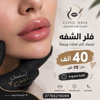 عرض لفترة محدودة 🔥 فلر الشفاه بـ 40 ألف فقط بدل 75 ألف 🤍  📞 للحجز والا...