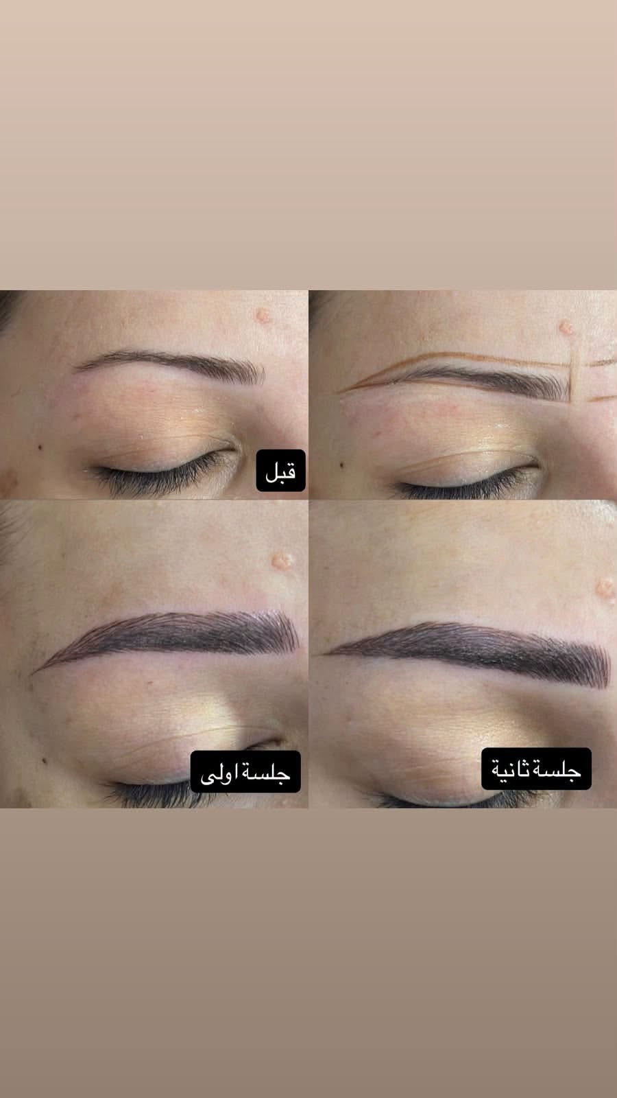 تاتو فايبروز • عرض مستمر • قبل وبعد