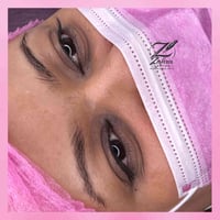 نانو بروز • ميكروبليدنج • زهره