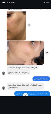 خلطة إيرانية عشبية • مبيض • توصيل مجاني
