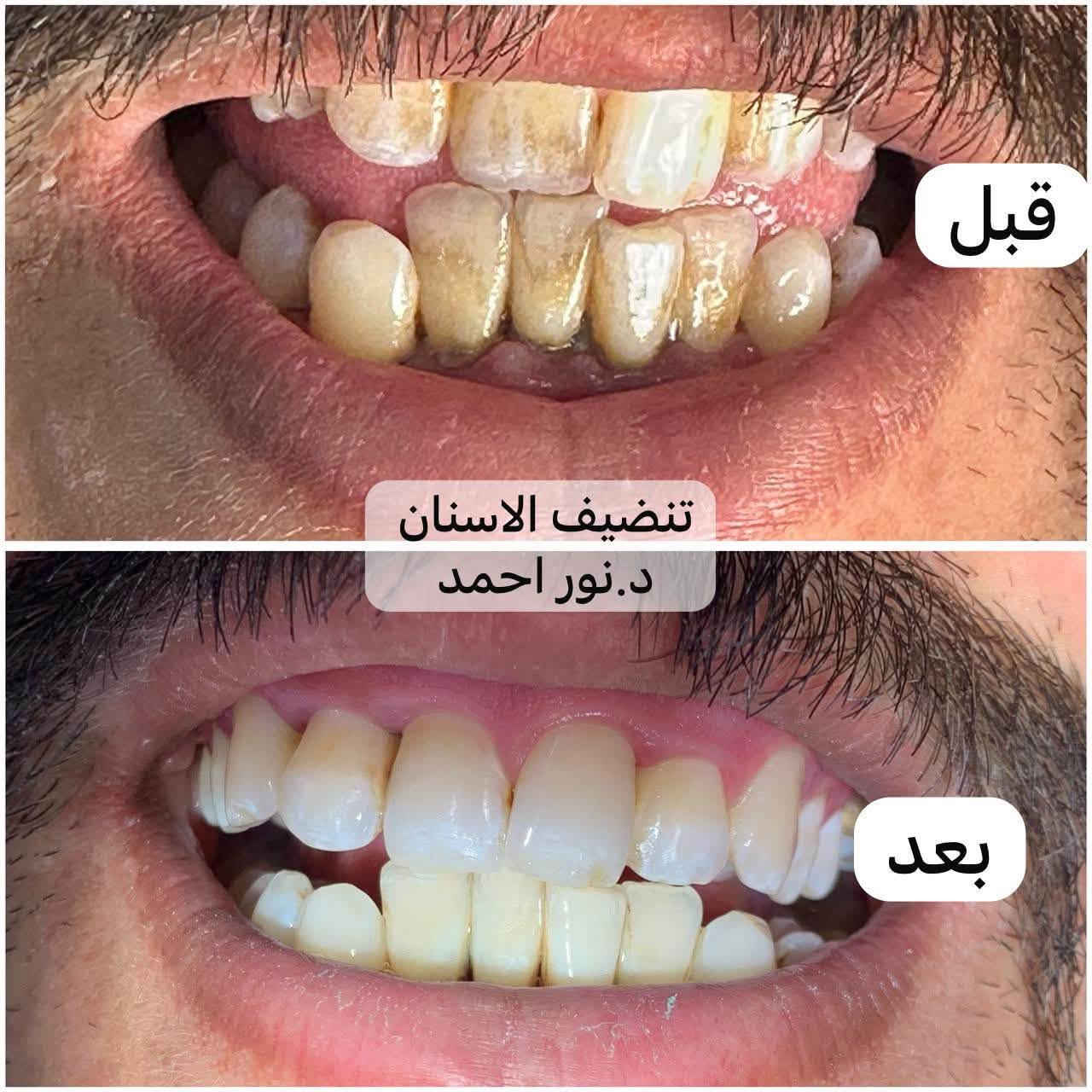 خدمات أسنان مجانية • تقويم متحرك • حله شارع ٤٠