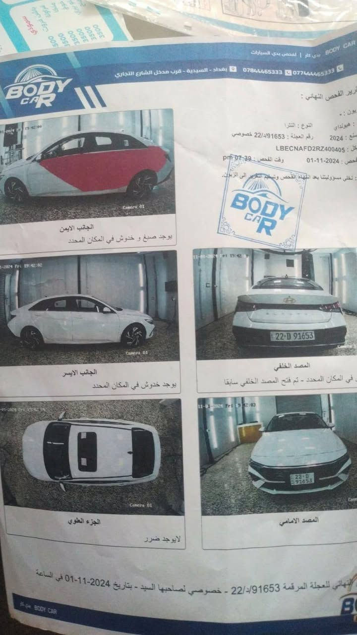النترا تجميع 2024
رقم اربيل فول مواصفات فتحه
كشنات جلد رادارات مري شفط
قطعتين تبريد ترحيب سونار موجود
بلمنشور تك مازده متشتغل
***********
