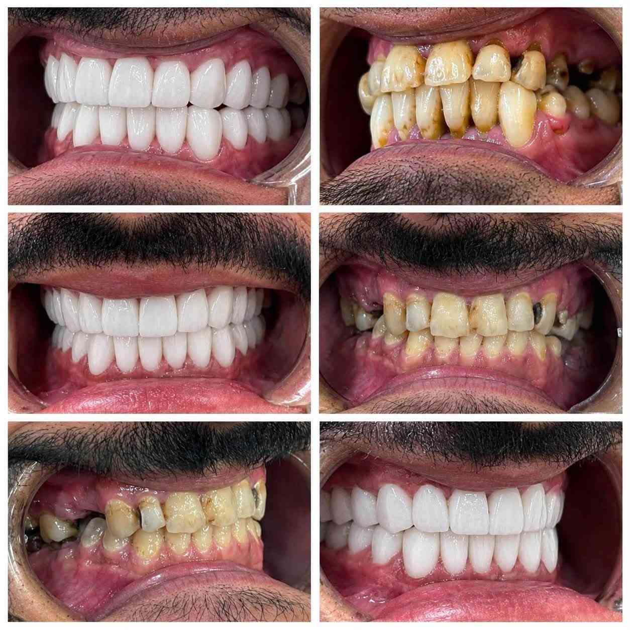 😁✨ ابتسامتك يمنا غير!

خلّي ابتسامتك تحچي عنك 🤍
عناية متخصصة وابتسامة تليق بملامحك مع كادر قسم الأسنان 🦷✨

📍 الموقع: واسط – العزيزية – شارع الخليج – جانب البوابة
📞 للحجز والاستفسار: ***********

🏥 مستشفى روح الحياة الأهلي
🦷 قسم الأسنان
