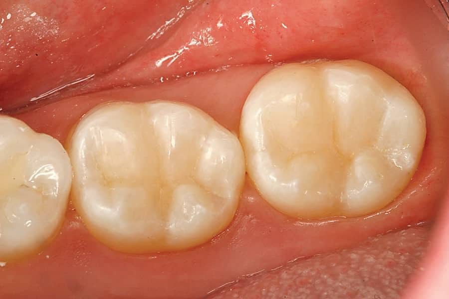 🦷✨ علاج أسنان مجاني وتحت إشراف أطباء اختصاص ✨🦷

إذا عندك مشكلة بأسنانك ومأجل علاجها، هاي فرصتك 🤍

أوفر لكم علاج وفحوصات أسنان مجاناً ضمن العيادات التعليمية، وبإشراف مباشر من أطباء أسنان اختصاص 👨‍⚕️🦷

🔹 تنظيف الأسنان وإزالة التكلسات
🔹 الحشوات ومعالجة التسوس
🔹 قلع الأسنان عند الحاجة
🔹 صناعة وتركيبات الأسنان
🔹 فحص وتشخيص ومتابعة الحالة
اذا عندك حالة كهذه راح نعالجها بل جامعة و تحت إشراف أطباء اختصاص 

📍 عيادات طب الأسنان – جامعة المستقبل
📍 سريع – حلة – نجف

💯 العلاج مجاني
👨‍⚕️ تحت إشراف أطباء اختصاص
🦷 الاهتمام بالحالة خطوة بخطوة

📩 إذا مهتم أو تعرف شخص يحتاج علاج، راسلني خاص او على الرقم واتساب *********** حتى ننسق الموعد.
