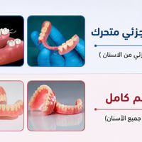 طقم جزئي • أخذ طبعة • جامعة البيان