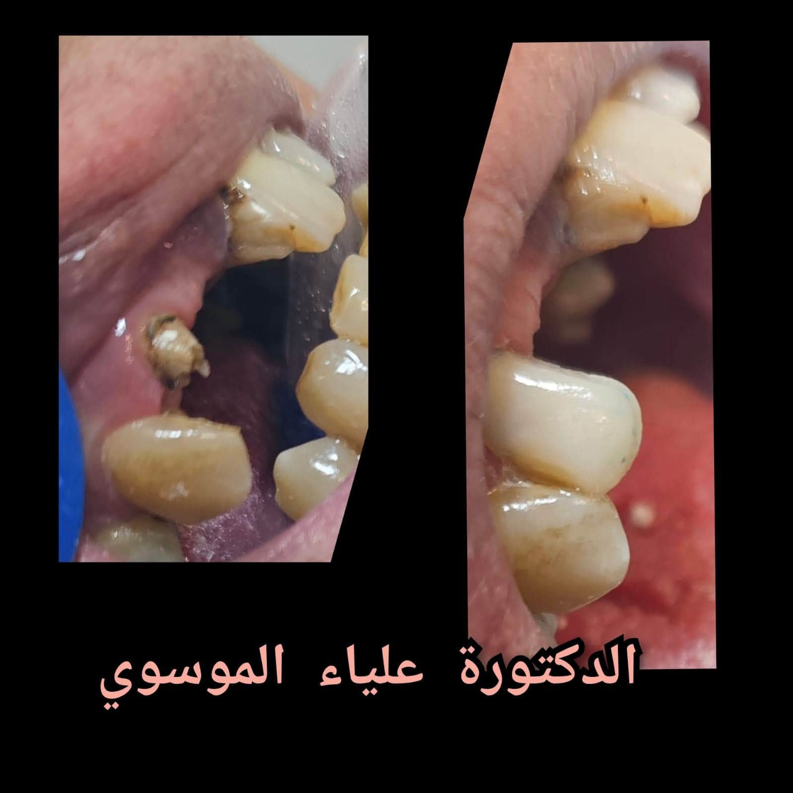 دكتورة أسنان • علياء الموسوي • المشتل شارع المطبك