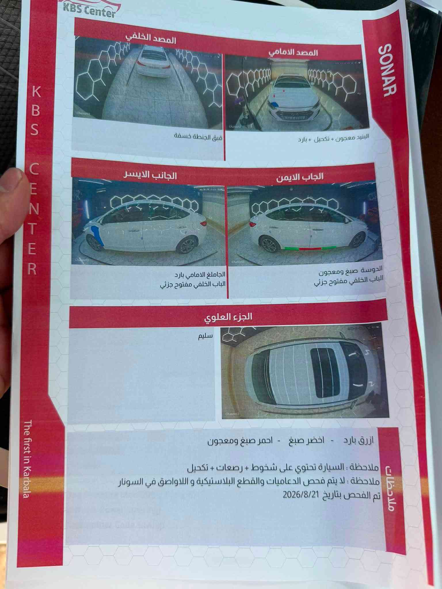 النتره مديل 18خليجي سياره كفاله عامه ماعده بارد بالجاملغ الامام شبر بارد السياره فول مواصفات عده البصمه والكشنات الجلد السياره جاهزه مكينه كير حداديه تخم تاير السياره باسمي تحويل ثاني يوم سنويه لل٢٠٢٨  السعر ١٤٠ 
***********

نص مكتوب في الصور:
- *********** رقم الهاتف