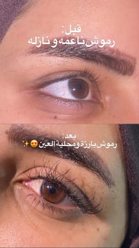 رموش كاملة • عيادة دجلة • عفك
