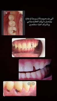 علاج مجاني • بالغين وأطفال • أطباء مختصين