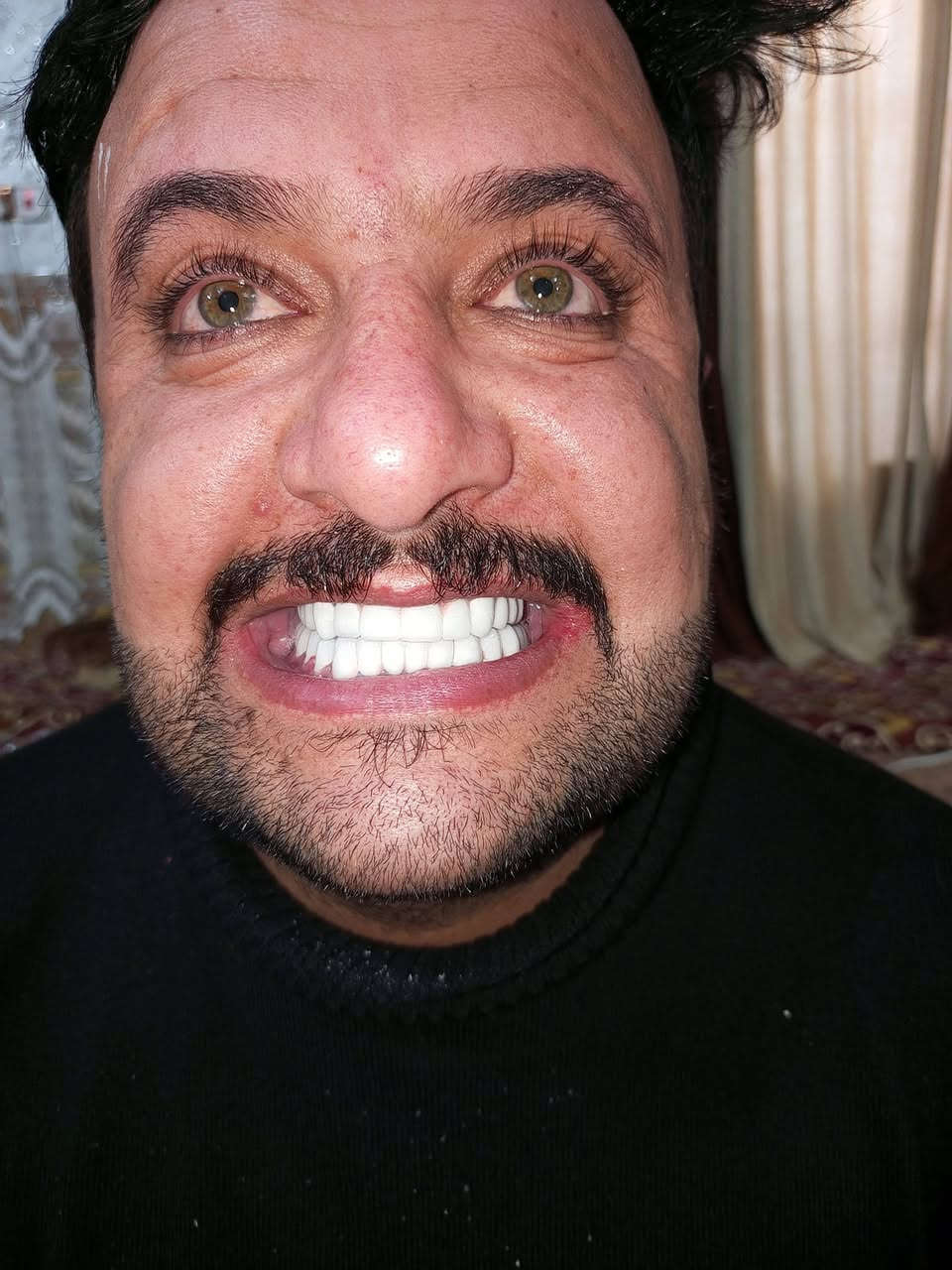 بعد ما اخفى المراجع ابتسامتة  لسنين 
صار الوقت انو يبتسم بكل ثقة بعد ان اكملنا علاج الاسنان 

المختبر الفني المختبر الفني السوري  لصناعة الاسنان
و التعويضات السنية وتركيب الأسنان
وبأنسب الاسعار بجميع المحافظات
العراقية 
ملاحظة لدينا كادر يزور المريض للبيت ويتم العمل في المنزل 
 للتواصل. ***********
