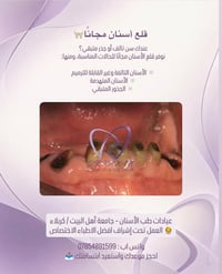 قلع أسنان مجاناً • جامعة أهل البيت • كربلاء