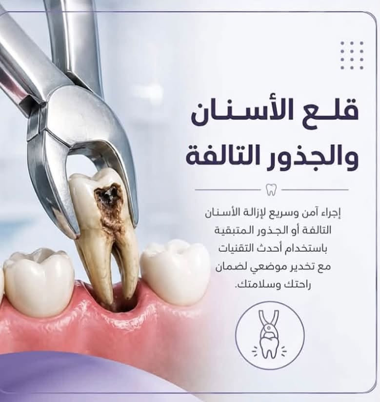 السلام عليكم 🙋🏻‍♀️
يوجد علاج مجاني للاسنان كما موضح بلصور الي يحب يحجز يتواصل دايركت💕
او 
واتساب:***********

📍 جامعة بلاد الرافدين _ديالى_بعقوبة_تقاطع القدس

علماً العلاج مجاني وتحت إشراف اطباء اختصاص💕

نص مكتوب في الصور:
- أهلاً وسهلاً بكم يسعدني استقبالكم في العيادات التعليمية لجامعة بلاد الرافدين. خدمات علاجية متنوعة للعناية بصحة الفم والأسنان. العيادات التعليمية - جامعة بلاد الرافدين / تقاطع القدس ***********
- تنظيف وإزالة التكلسات والتصبغات تنظيف احترافي لإزالة التكلسات والتصبغات المتراكمة على الأسنان بأجهزة حديثة وآمنة، لنمنحك أسناناً أنظف وأكثر صحة ونفساً أكثر انتعاشاً.
- حشوات ضوئية وتجميلية حشوات ضوئية وتجميلية بلون الأسنان، تمنح مظهراً طبيعياً وتعيد للسن شكله ووظيفته بأعلى معايير الجودة والدقة، مع الحفاظ على صحة السن لأطول فترة ممكنة.
- قلع الأسنان والجذور التالفة إجراء آمن وسريع لإزالة الأسنان التالفة أو الجذور المتبقية باستخدام أحدث التقنيات مع تخدير موضعي لضمان راحك وسلامتك.
- طقم كامل متحرك أطقم كاملة متحركة مصنوعة بأعلى المعايير الطبية لتعويض جميع الأسنان المفقودة، تمنحك مظهراً طبيعياً ووظيفة ممتازة للمضغ والكلام، مع راحة وثبات فائقة.