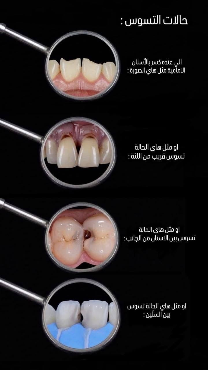 المنصور • جامعة التراث • العلاج مجاني
