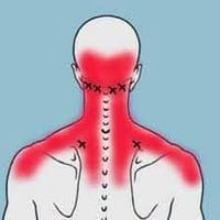 ليس كل الم في الرقبة معناها انزلاق هناك الكثير من الاسباب التي تؤدي ال...