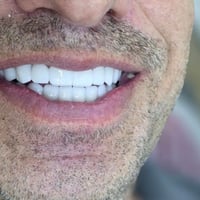 ابتسامة هوليود • ٢٥ سنة خبرة • هولير نوي