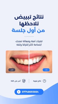 عيادة سمايل زون • تجميل أسنان • زين القوس