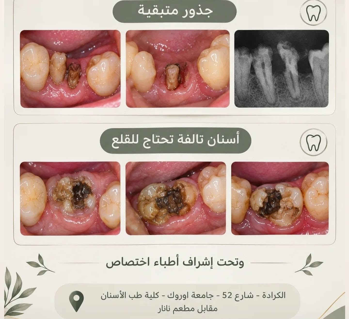 علاج أسنان مجاني • الكرادة شارع ٥٢ • أسنان أطفال