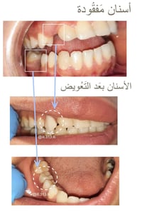 العلاج مجاناً • حجز الشهر الثامن • الكرادة