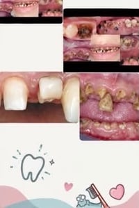 علاج مجاني • أطباء مختصين • جامعة كلكامش