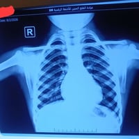 أشعة رقمية • DR Varex • عنصر نسوي