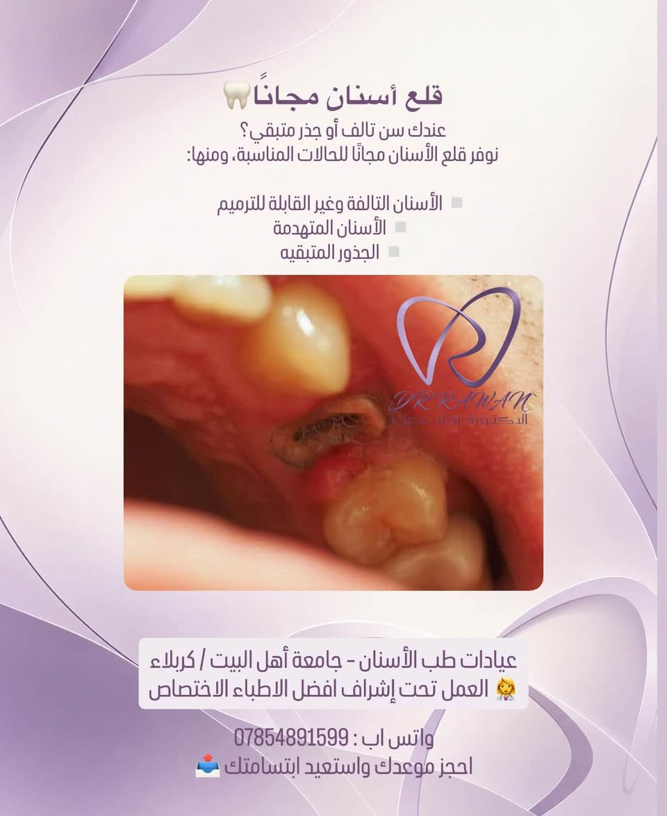 قلع أسنان مجاناً • جامعة أهل البيت • كربلاء