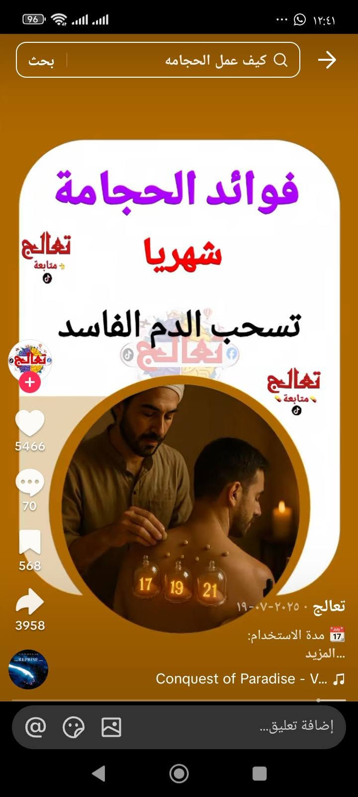 حجامة شهرية • تحسين النوم • تخفيف صداع