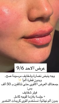 العرض لـ أول 10 زبائن فقط  شنو منتضرين!!😍👄✨ثبتو حجزكم وتألقو باقوى عرض...