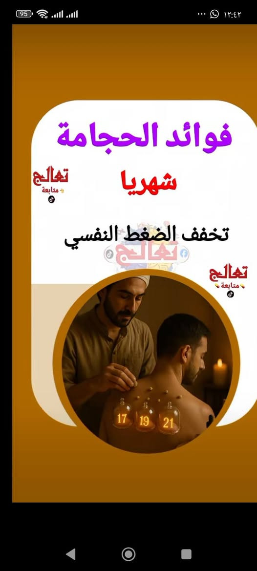 حجامة شهرية • تحسين النوم • تخفيف صداع